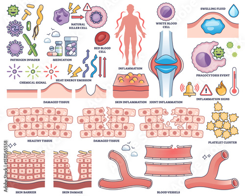 Inflammatory response shows immune cells, inflamed joints, and tissue damage, illustrating the bodys defense mechanisms, transparent background. Outline style collection
