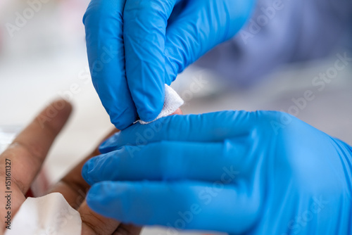 Close-up of a healthcare worker wearing blue gloves cleaning a patient’s fingertip with cotton, preparing for a medical procedure or blood test in a clinical setting.