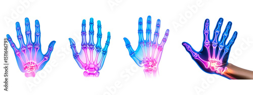 Human hand X-ray style illustration highlighting joint pain set  isolated on transparent or white background	