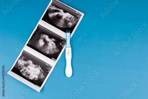 Photos Positive pregnancy test with gynecological ultrasound image, symbolizing pregnancy, family planning, and maternal health