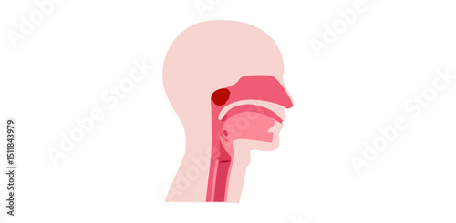 Enlarged adenoids poster
