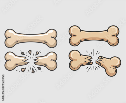  Broken or Fracture Bone