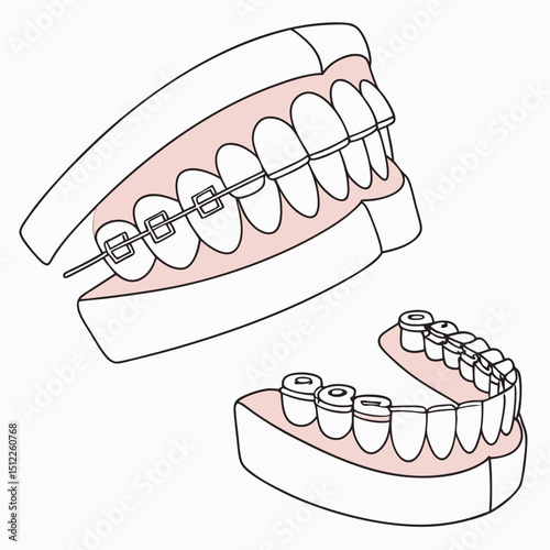 Orthodontic braces and dental models in simple illustration style  