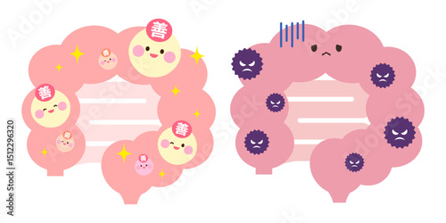 良好な腸と不調な腸　比較イラスト