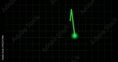 Animated ECG Heartbeat Graph Vector – Electrocardiogram Line Medical Animation