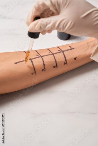 Skin prick allergy to find out kind of allergy