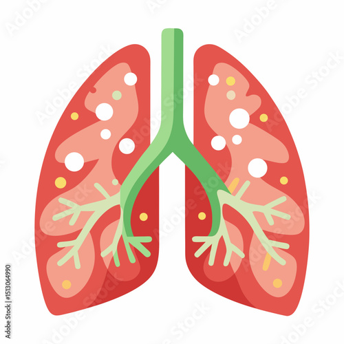 World Bronchiectasis Day Vector Illustration – Lung Disease Awareness, Respiratory Health, Medical Education