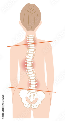 背骨の歪み　女性