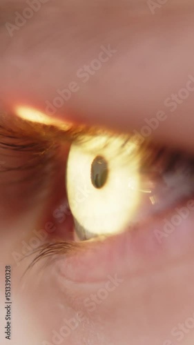 Vertical Video. Close-up of an eye. Close-up of an ophthalmological examination in a modern ophthalmology clinic. Vision correction and examination. Diagnosis of vision at an early age.