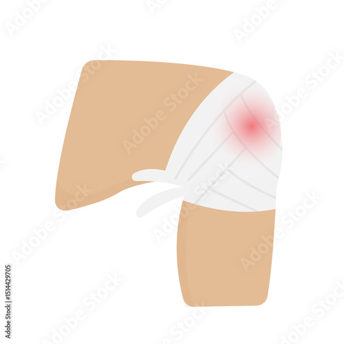 vector of injured and bandaged knee