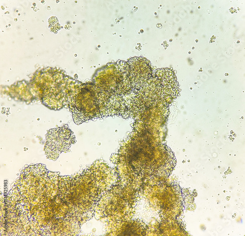 Spheroids of glioblastoma cell culture.
