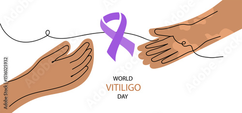 world vitiligo day banner, line art vector illustration. two vitiligo skin hands isolated on white background.