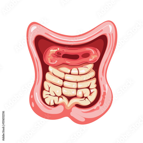 Detailed Anatomical Illustration of Intestines in Simplified Style with Light Pink Outline on White Background for Medical Purposes