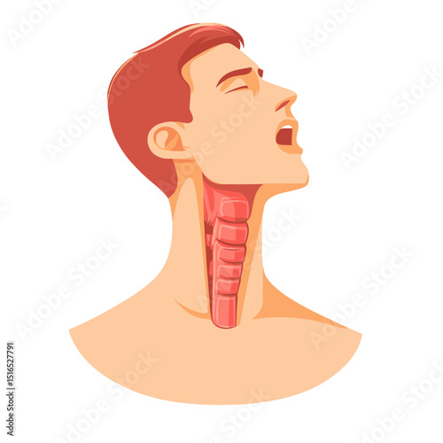 Anatomical Illustration of Throat Inflammation in Pixel Art Style Featuring Reddish Tones on a White Background Highlighting Medical Condition