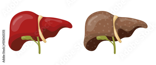 Healthy liver and cirrhotic liver showing cirrhosis medical concept