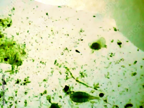 Trnsparent an microscopic rotifer looking for food in the water