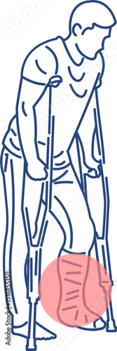 Vector illustration of man with broken leg using crutches and cast