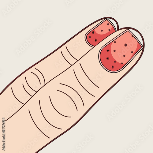Infected Finger with Wart Vector Illustration
