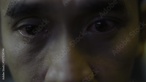 Irritated Red Blood Eye Full With Capillary Net Allergy Close-up, Video footage for medical and cinematic in eye scene.