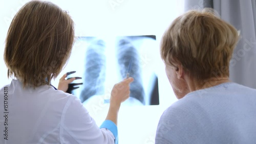 Medical professional carefully analyzing chest x ray, explaining diagnostic imaging findings to patient while pointing at radiographic results in clinical healthcare setting
