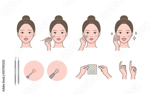 A cute woman character who extracts and removes whitehead, zit, acne with pimple potter tool and trouble patch