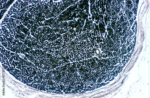Nerve fibers. Myelin. Osmium tetroxyte photo