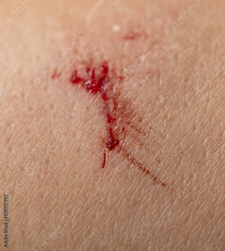 A red mark on a person's arm