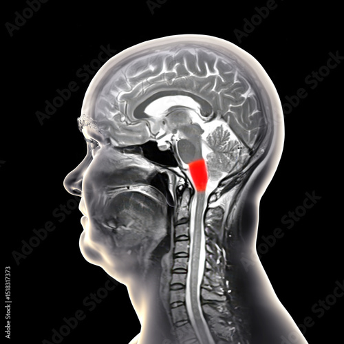 Medulla oblongata highlighted in human brain, composite colored MRI and 3D illustration