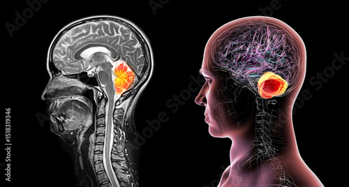 Cerebellum, 3D illustration and colored composite MRI