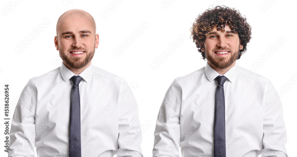 Baldness. Man before and after wearing wig or hair treatment, collage Baldness. Man before and after wearing wig or hair treatment, collage