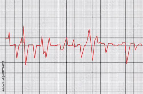 ECG Heartbeat Analysis Understanding Cardiogram Patterns