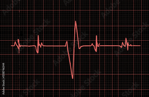 ECG Heartbeat Waveform Medical Illustration of Cardiogram