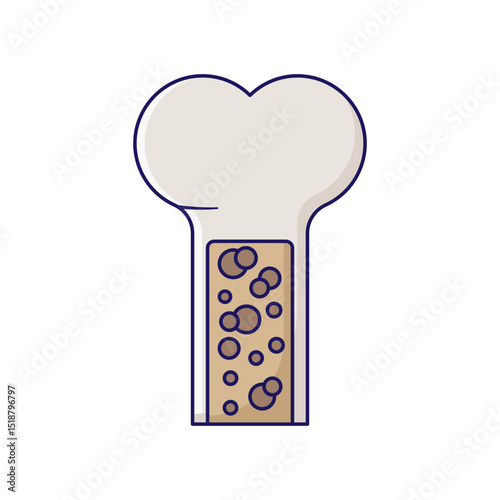 Bone DIsease