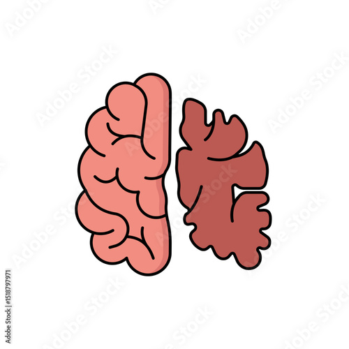 alzheimer disease illustration