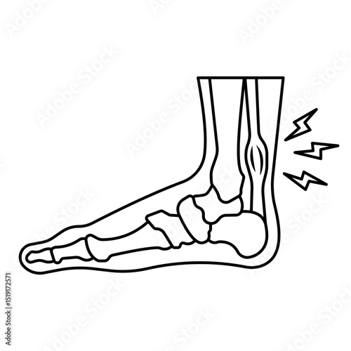 Achilles Tendinitis