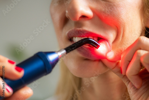 Red light therapy applied to the mouth promotes healing of oral tissues and reduces inflammation. It enhances circulation, supporting faster recovery and oral health.