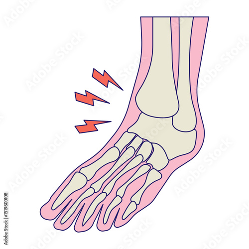 Arthritis icon