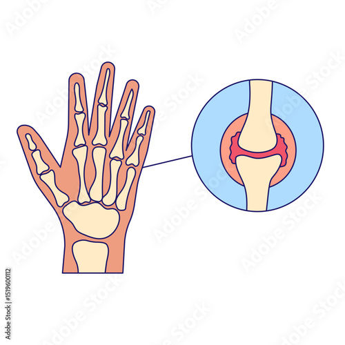 Arthritis icon