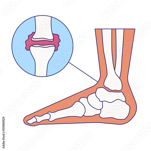 Arthritis icon