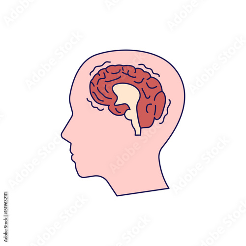 Alzheimer disease