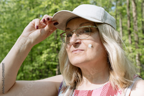 Smiling mature woman in a cap and glasses with a small adhesive bandage on her cheek while enjoying a sunny day outdoors.
