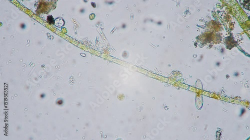 The amazing world of microbiology. Different bacteria, microbes and single-celled microorganisms are visible through a microscope. High-quality video.	
