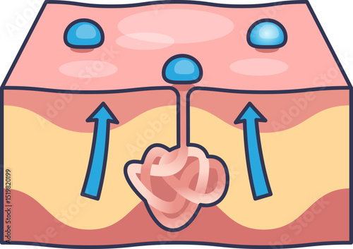 Illustration of a sweat gland in skin, showing sweat production and release.