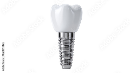 Wallpaper Mural Dental implant: a detailed view of a single, pristine dental implant, showcasing the innovative fusion of bio-compatible materials for a confident, natural smile. Torontodigital.ca