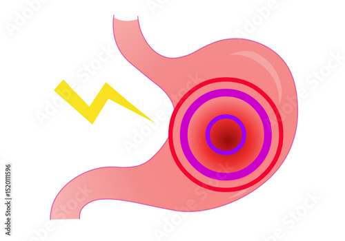 Stomach  problems. Acid reflux, pancreas pain, gastro problems, gastric, disease, cancer digestive gastrointestinal. digestive system. Vector illustration