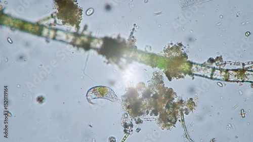 The amazing world of microbiology. Different bacteria, microbes and single-celled microorganisms are visible through a microscope. High-quality video.	

