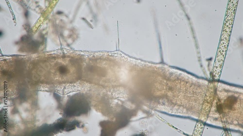 The amazing world of microbiology. Different bacteria, microbes and single-celled microorganisms are visible through a microscope. High-quality video.	
