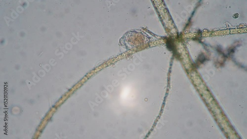The amazing world of microbiology. Different bacteria, microbes and single-celled microorganisms are visible through a microscope. High-quality video.	
