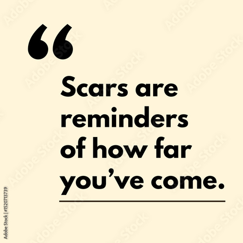 Scars are reminders of how far you've come. - Motivational Quote