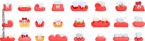 Periodontitis icons set. Set of icons representing different stages and symptoms of gum diseases like periodontitis and gingivitis, from plaque and bleeding to tooth loss